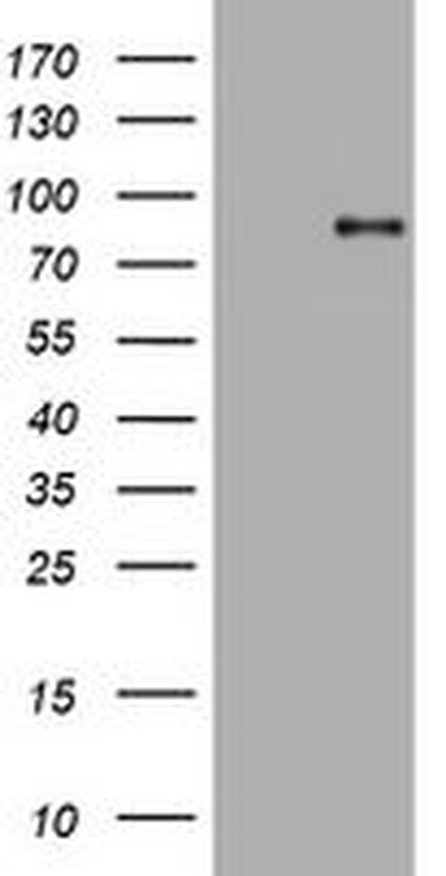 AFAP1 Antibody in Western Blot (WB)