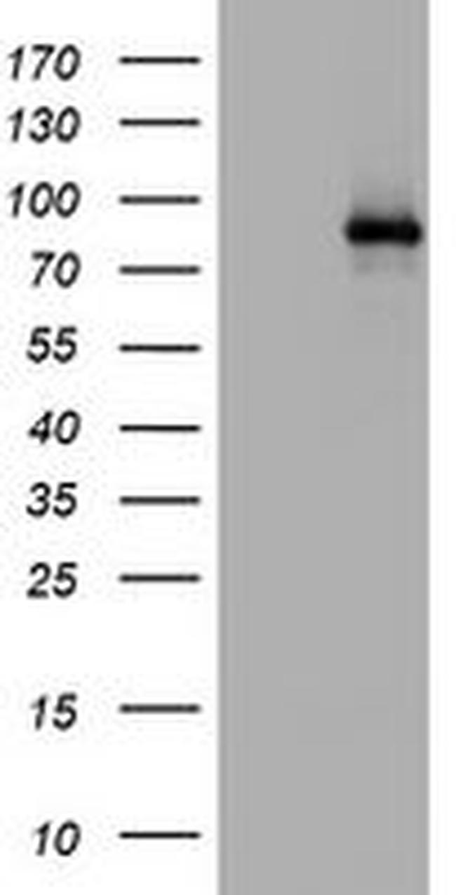 AFAP1 Antibody in Western Blot (WB)