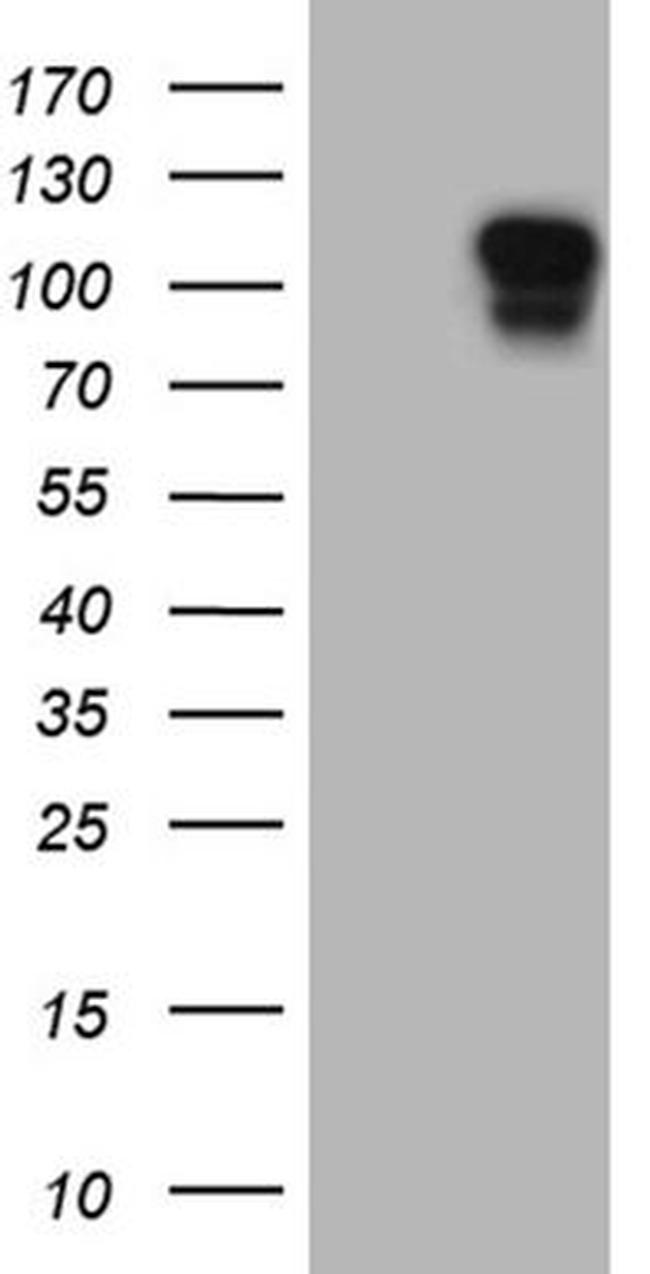 AFAP1 Antibody in Western Blot (WB)