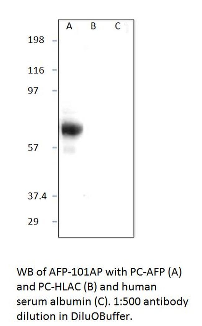 Alpha 1 Fetoprotein Antibody in Western Blot (WB)