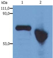 AFP Antibody in Western Blot (WB)