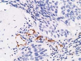 AFP Antibody in Immunohistochemistry (Paraffin) (IHC (P))