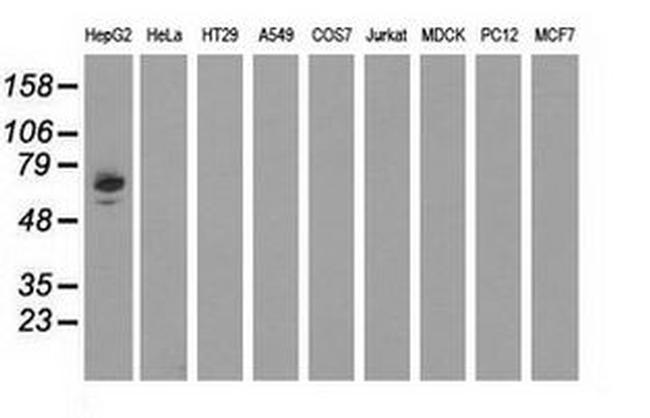 AFP Antibody in Western Blot (WB)