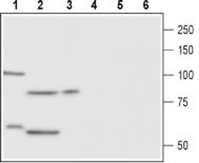 FSHR (extracellular) Antibody in Western Blot (WB)