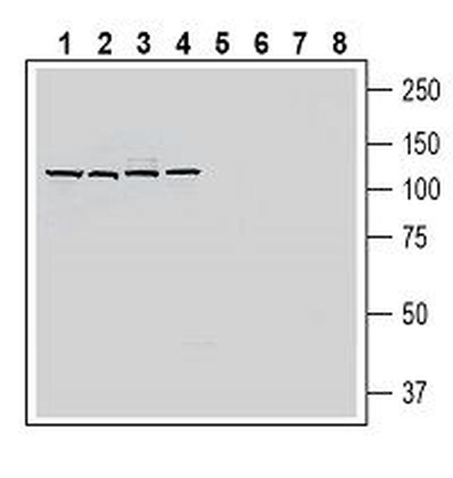 SLC19A1/RFC1 (extracellular) Antibody in Western Blot (WB)