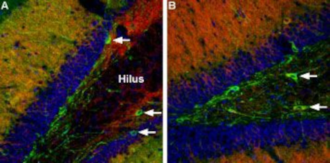 GABA(A) alpha 1 Receptor (extracellular) Antibody in Immunohistochemistry (IHC)