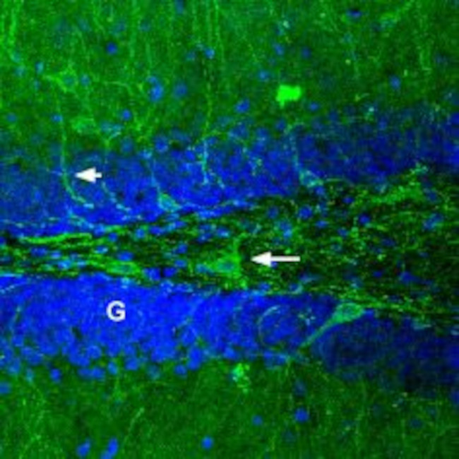 GABA(A) alpha 1 Receptor (extracellular) Antibody in Immunohistochemistry (IHC)