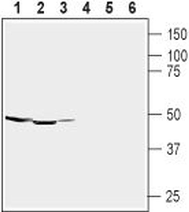 GABA(A) alpha 1 Receptor (extracellular) Antibody in Western Blot (WB)