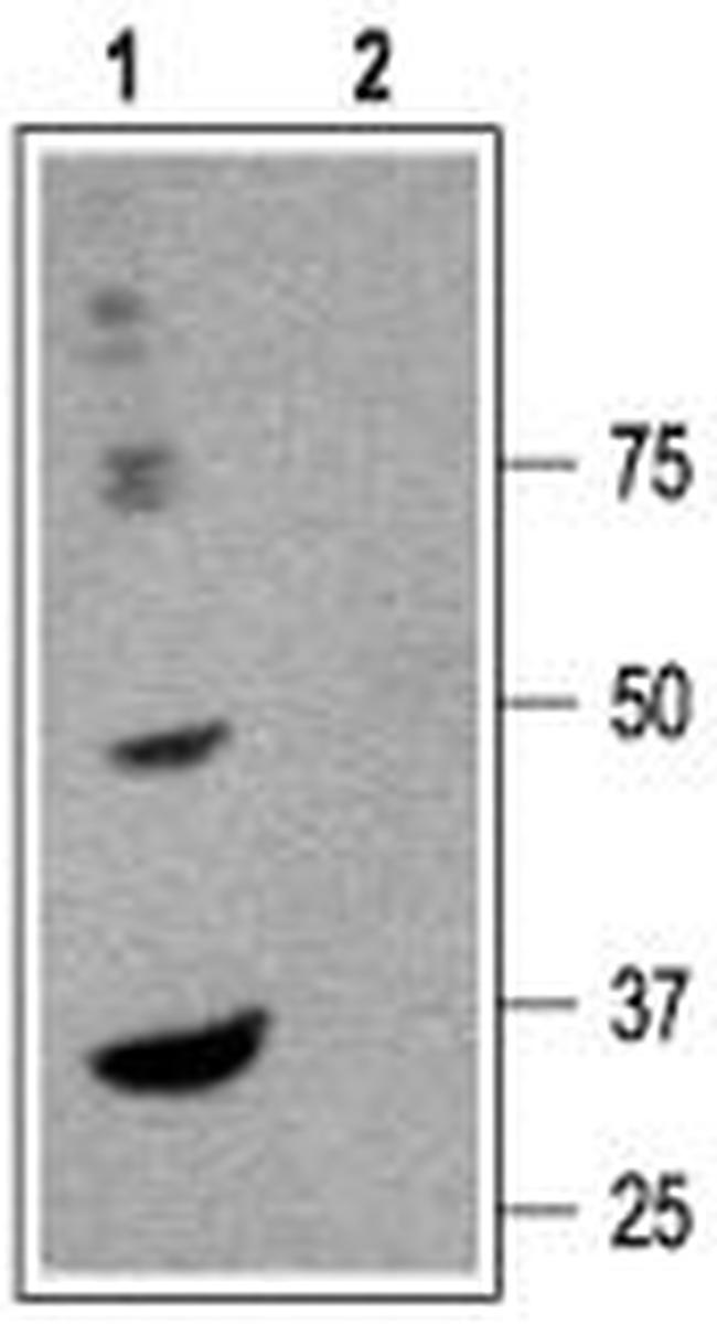 GABA(A) alpha 6 Receptor (extracellular) Antibody in Western Blot (WB)