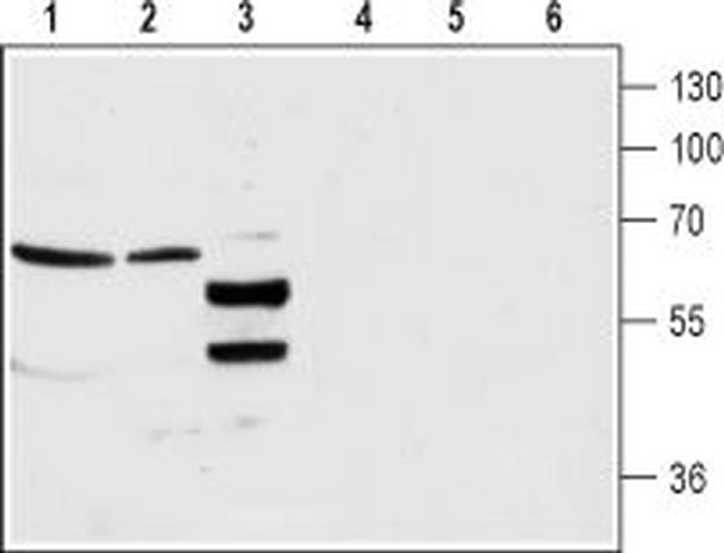 GABA(A) alpha 4 Receptor (extracellular) Antibody in Western Blot (WB)