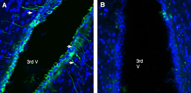 GABA(A) beta 2 Receptor Antibody in Immunohistochemistry (Frozen) (IHC (F))