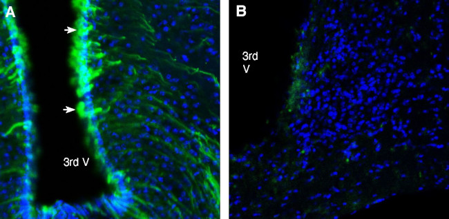 GABA(A) beta 2 Receptor Antibody in Immunohistochemistry (Frozen) (IHC (F))