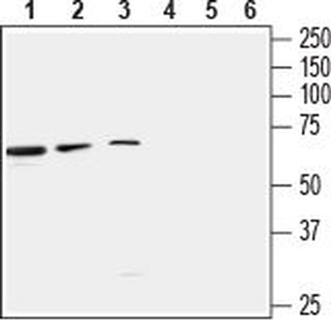 GABA(A) beta 3 Receptor Antibody in Western Blot (WB)