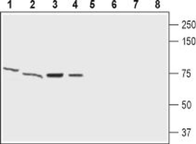 GABA(A) epsilon Receptor (GABRE) (extracellular) Antibody in Western Blot (WB)