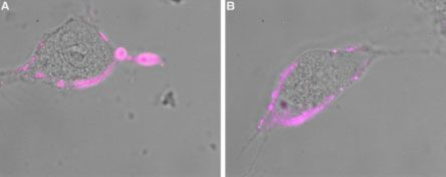 GABA(A) epsilon Receptor (GABRE) (extracellular) Antibody in Immunocytochemistry (ICC/IF)