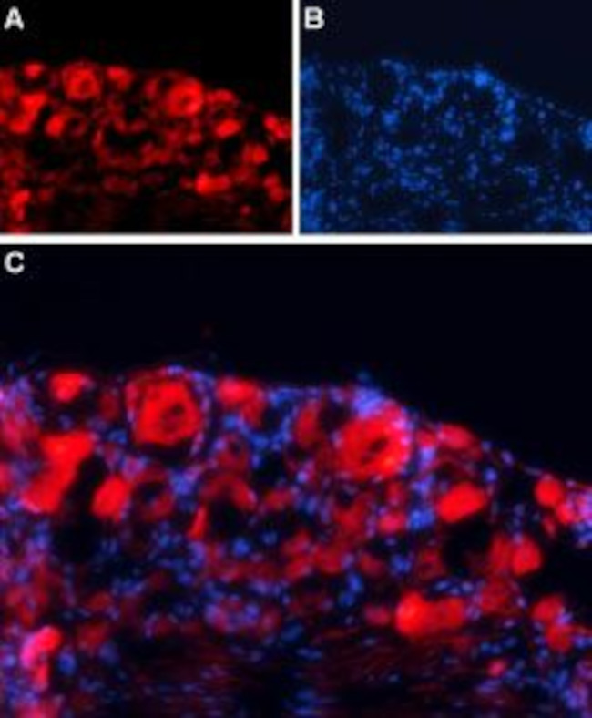 GABA(A) gamma 1 Receptor Antibody in Immunohistochemistry (Frozen) (IHC (F))