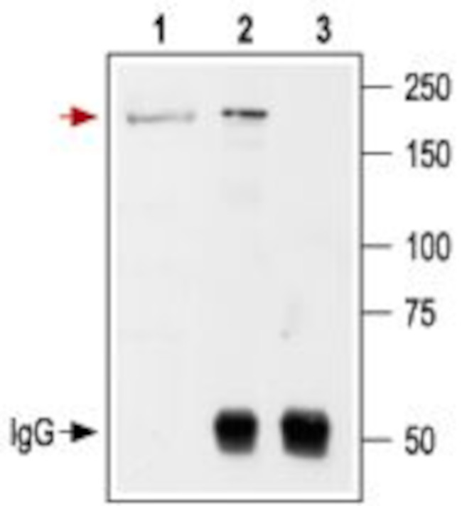 NMDAR2B (GluN2B) (extracellular) Antibody in Immunoprecipitation (IP)