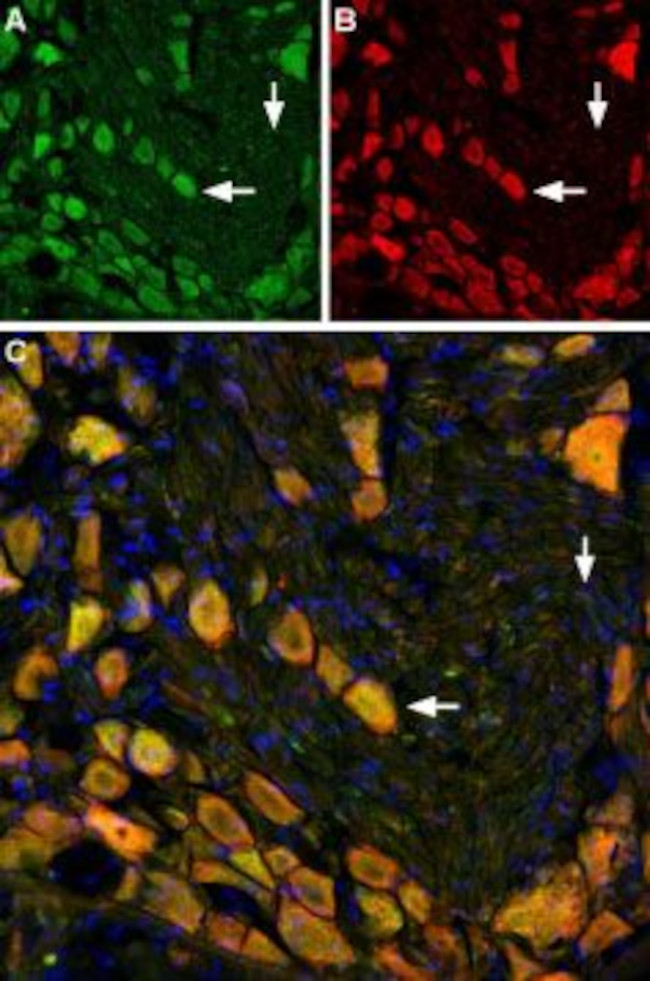 mGluR5 (extracellular) Antibody in Immunohistochemistry (Frozen) (IHC (F))