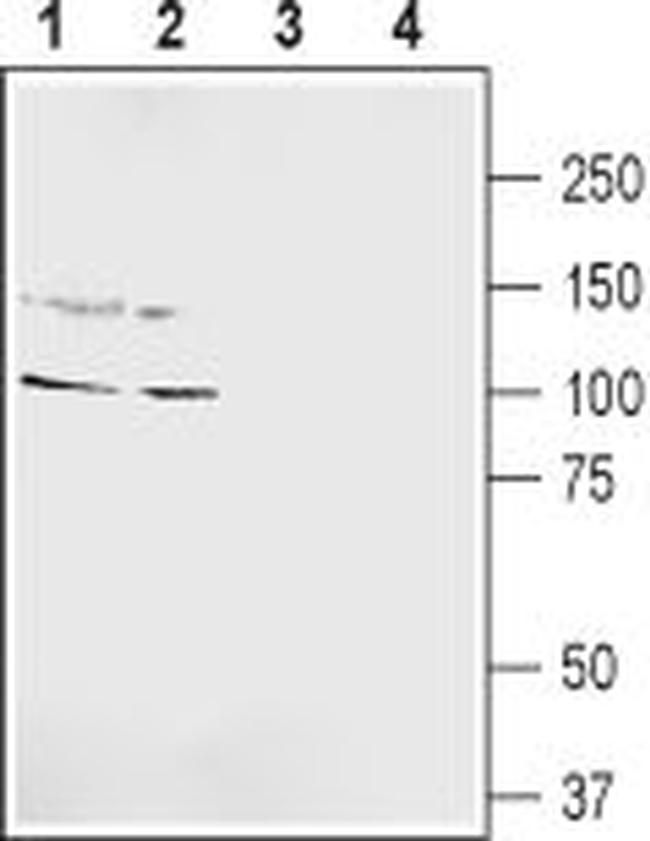 GRIK5 (GluK5) (extracellular) Antibody in Western Blot (WB)