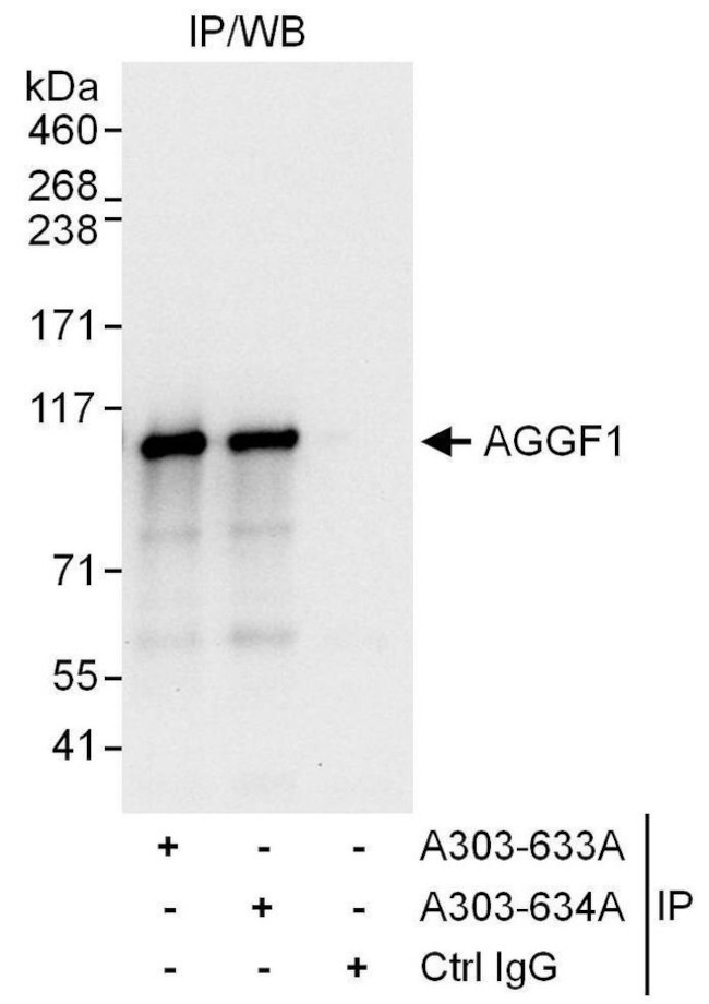 AGGF1 Antibody in Immunoprecipitation (IP)