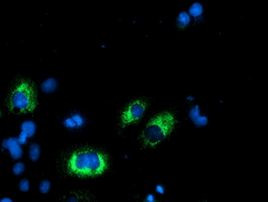 AGPAT5 Antibody in Immunocytochemistry (ICC/IF)