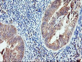 AGPAT5 Antibody in Immunohistochemistry (Paraffin) (IHC (P))