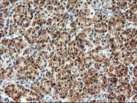 AGPAT5 Antibody in Immunohistochemistry (Paraffin) (IHC (P))