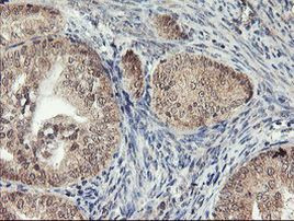 AGPAT5 Antibody in Immunohistochemistry (Paraffin) (IHC (P))