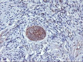 AGPAT5 Antibody in Immunohistochemistry (Paraffin) (IHC (P))