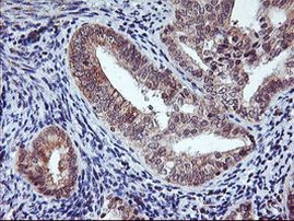 AGPAT5 Antibody in Immunohistochemistry (Paraffin) (IHC (P))