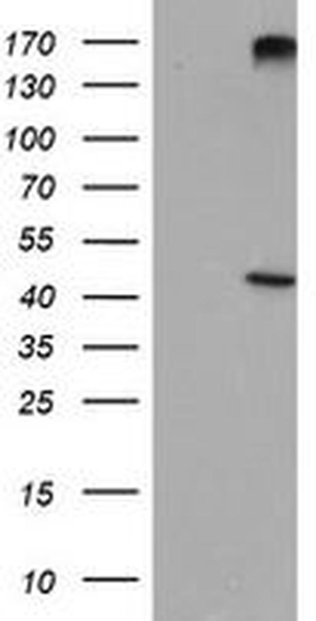 AGPAT5 Antibody in Western Blot (WB)