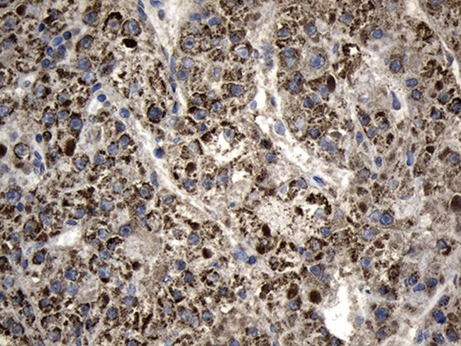 AGPAT9 Antibody in Immunohistochemistry (Paraffin) (IHC (P))