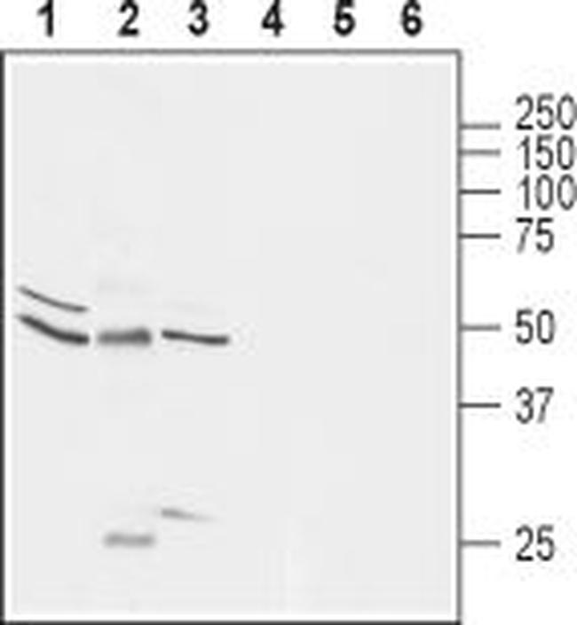 Glycine Receptor alpha 1 Antibody in Western Blot (WB)