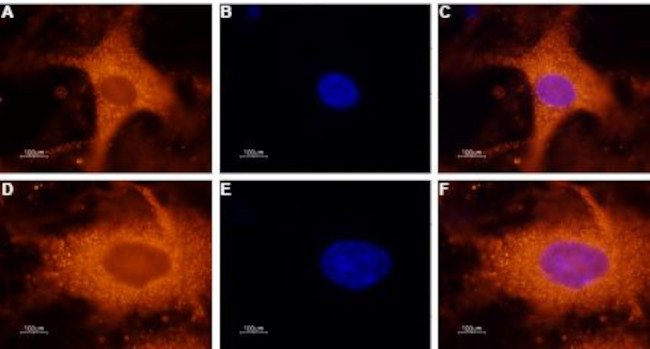 GALR1 Antibody in Immunocytochemistry (ICC/IF)