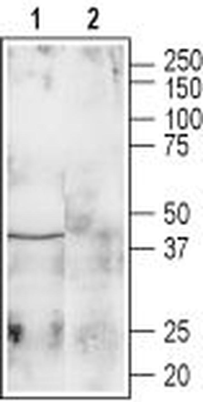 GALR1 Antibody in Western Blot (WB)