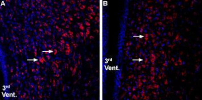 Ghrelin Receptor (GHSR) (extracellular) Antibody in Immunohistochemistry (IHC)