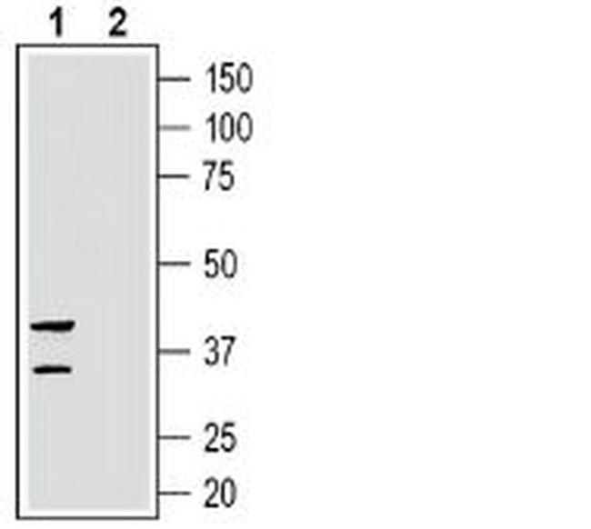 GPR35 (extracellular) Antibody in Western Blot (WB)