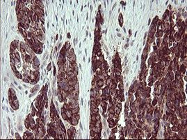 ARG2 Antibody in Immunohistochemistry (Paraffin) (IHC (P))