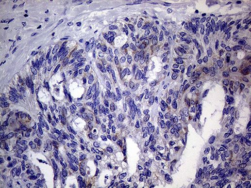 AGR2 Antibody in Immunohistochemistry (Paraffin) (IHC (P))