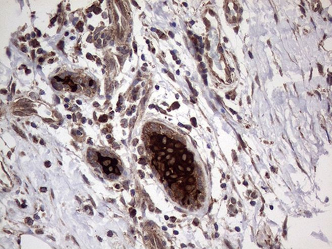 AGR2 Antibody in Immunohistochemistry (Paraffin) (IHC (P))