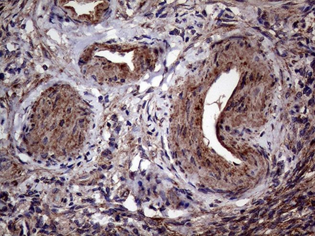 AGR2 Antibody in Immunohistochemistry (Paraffin) (IHC (P))