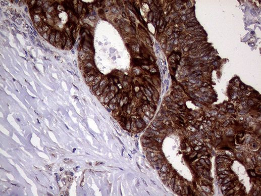 AGR2 Antibody in Immunohistochemistry (Paraffin) (IHC (P))