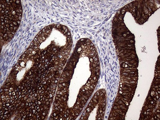 AGR2 Antibody in Immunohistochemistry (Paraffin) (IHC (P))