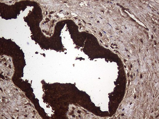 AGR2 Antibody in Immunohistochemistry (Paraffin) (IHC (P))