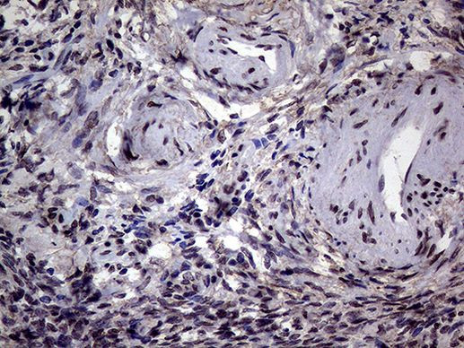 AGR2 Antibody in Immunohistochemistry (Paraffin) (IHC (P))