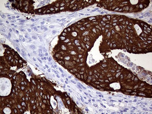 AGR2 Antibody in Immunohistochemistry (Paraffin) (IHC (P))