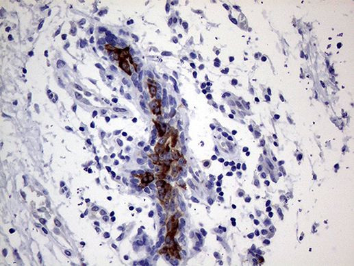 AGR2 Antibody in Immunohistochemistry (Paraffin) (IHC (P))