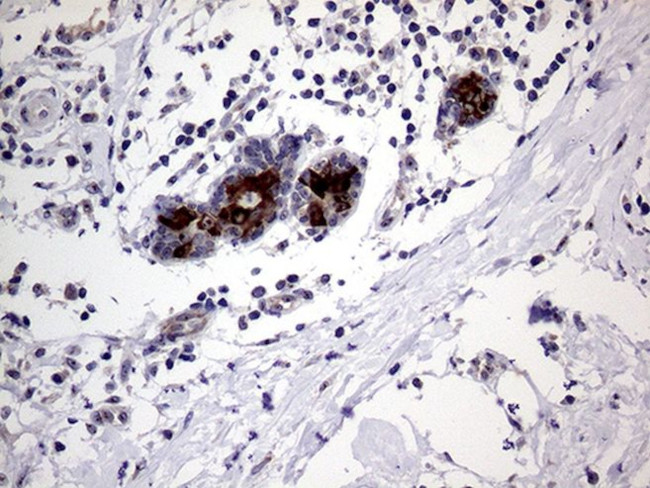 AGR2 Antibody in Immunohistochemistry (Paraffin) (IHC (P))