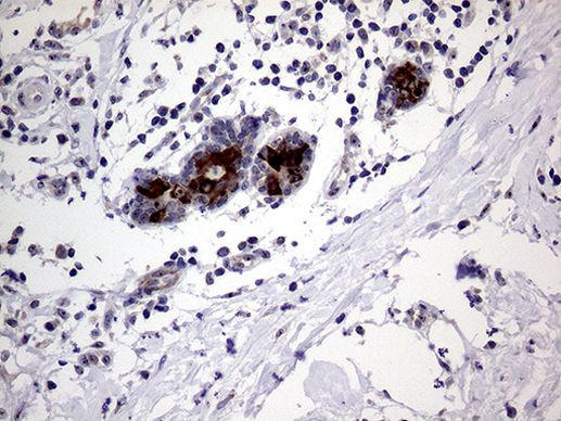 AGR2 Antibody in Immunohistochemistry (Paraffin) (IHC (P))