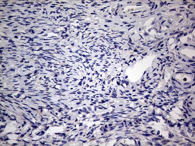 AGR2 Antibody in Immunohistochemistry (Paraffin) (IHC (P))